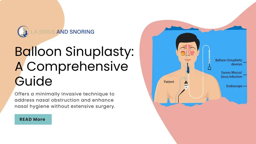 What is Balloon Sinuplasty: A Comprehensive Guide