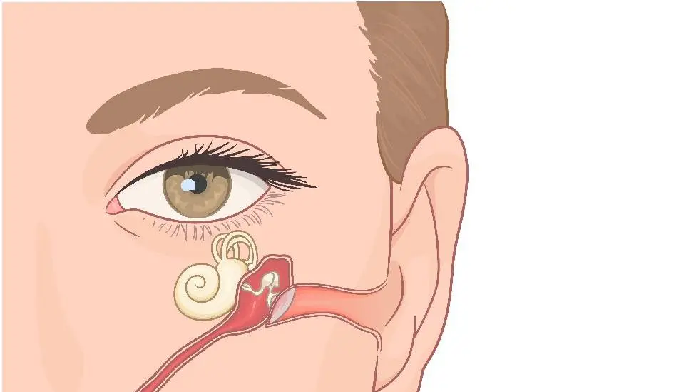 Eustachian Tube Dysfunction: Causes, Symptoms, &amp; Treatment